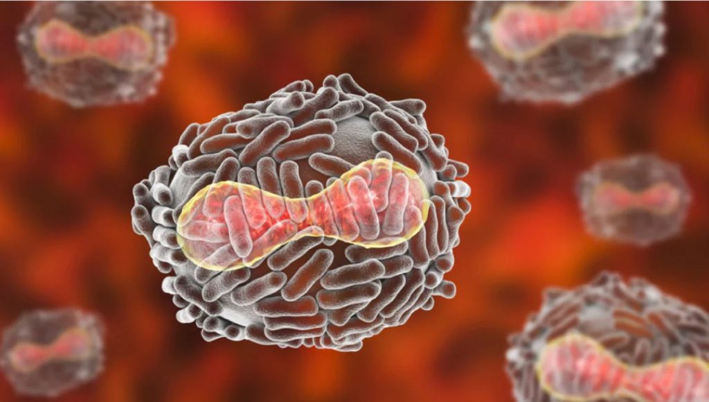 Virus vaiolo delle scimmie sintomi